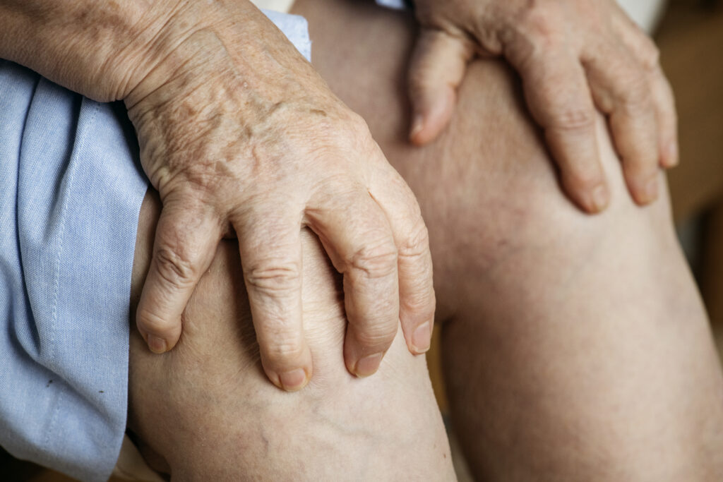 Elderly woman suffering knee pain